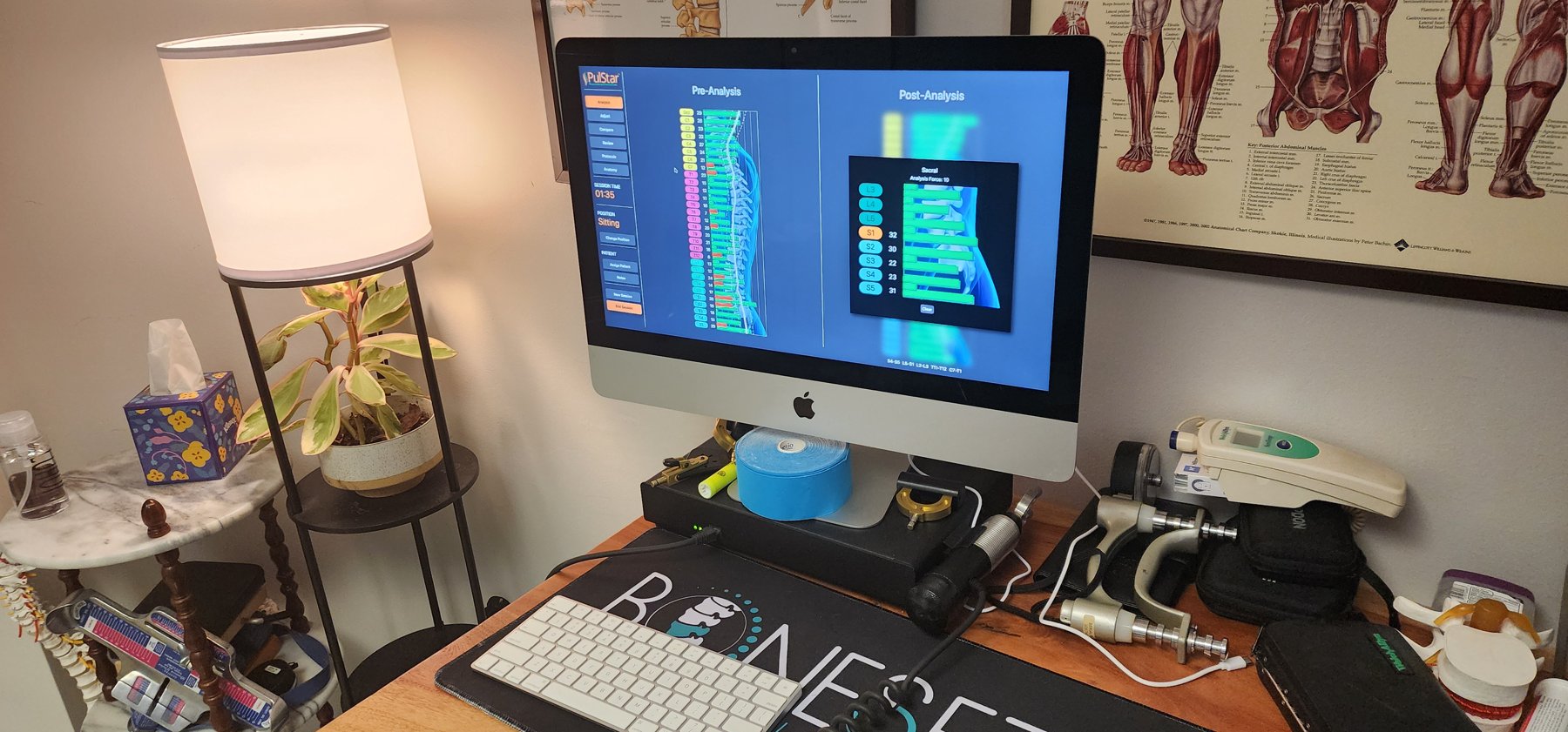 PulStar computer-guided adjusting station showing pre and post cervical spinal analysis at Bonesetters in Chesterfield, MO